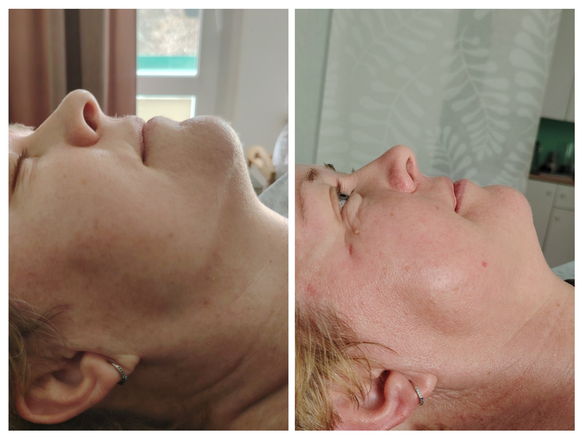 Lymfa Craft®- Face